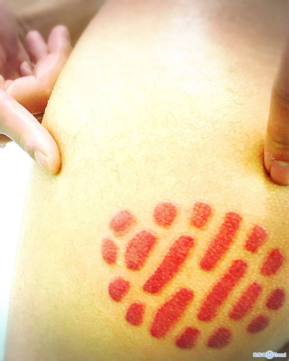 屁股泡温泉的后果